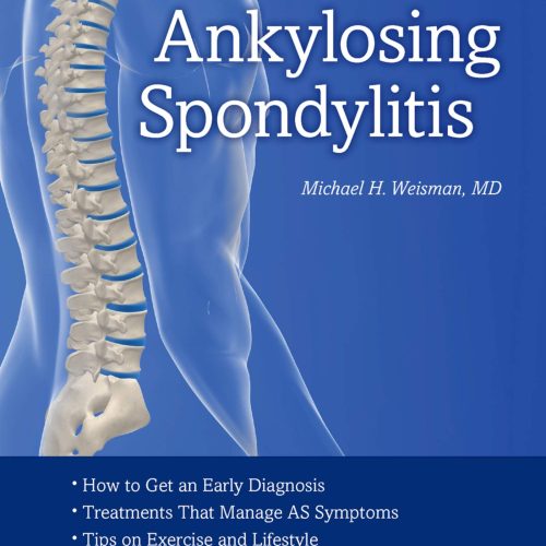 Ankylosing Spondylitis